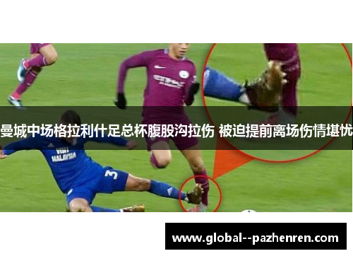 曼城中场格拉利什足总杯腹股沟拉伤 被迫提前离场伤情堪忧 曼城中场格拉利什足总杯腹股沟拉伤 被迫提前离场伤情堪忧